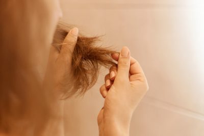 perte de cheveux