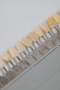 implants dentaires