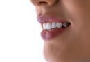 un gros plan de la bouche d'une femme avec des dents blanches