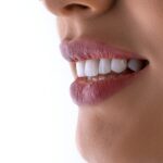 un gros plan de la bouche d'une femme avec des dents blanches