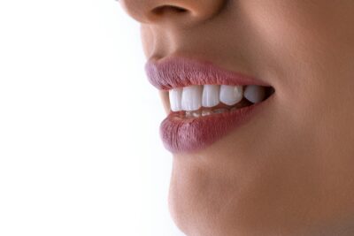 un gros plan de la bouche d'une femme avec des dents blanches