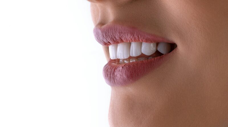 un gros plan de la bouche d'une femme avec des dents blanches